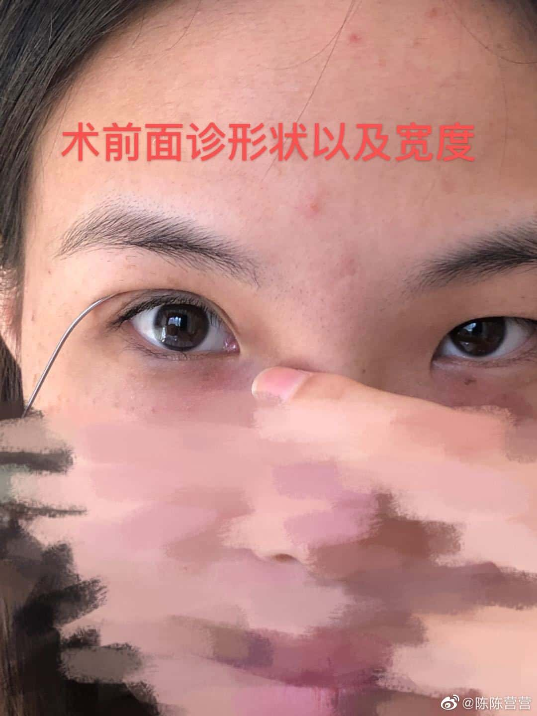 张家口维多利亚医疗整形美容机构,刘学琴