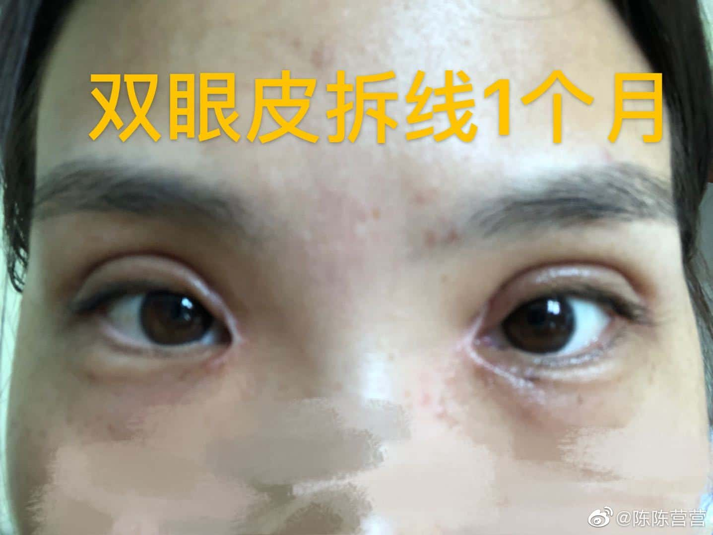 张家口维多利亚医疗整形美容机构,刘学琴