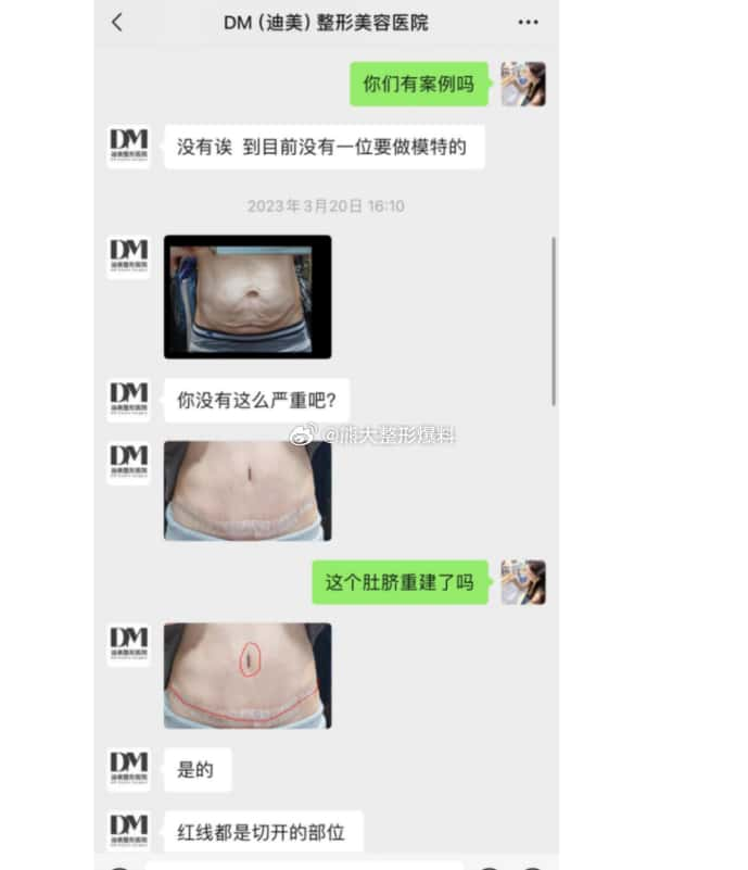 迪美DM,柳院长