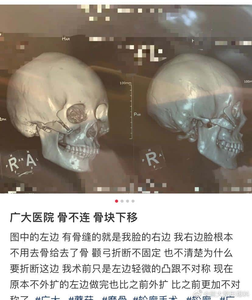 广大医院,罗延平